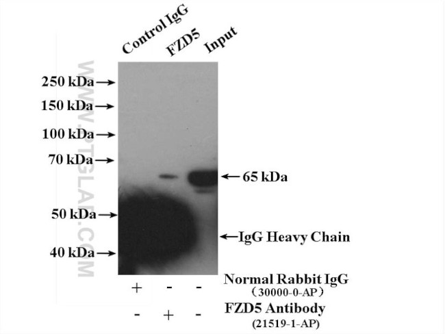 FZD5 Antibody in Immunoprecipitation (IP)