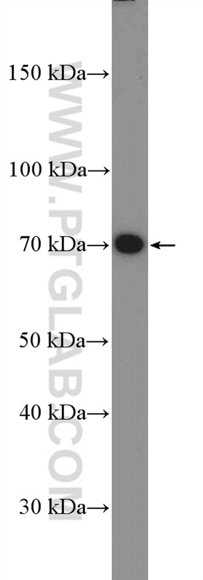 FZD5 Antibody in Western Blot (WB)