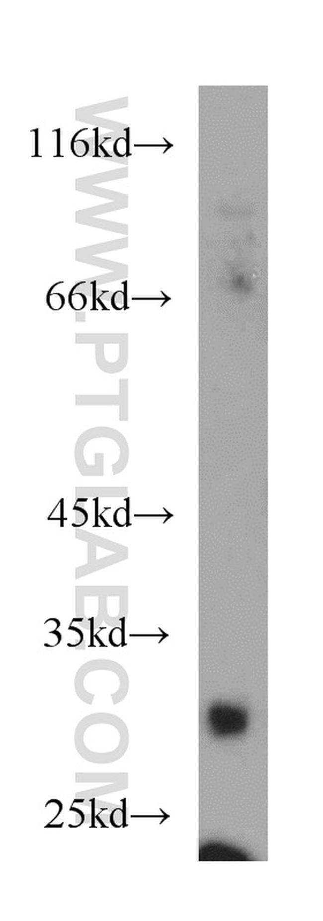 TNFRSF13B Antibody in Western Blot (WB)