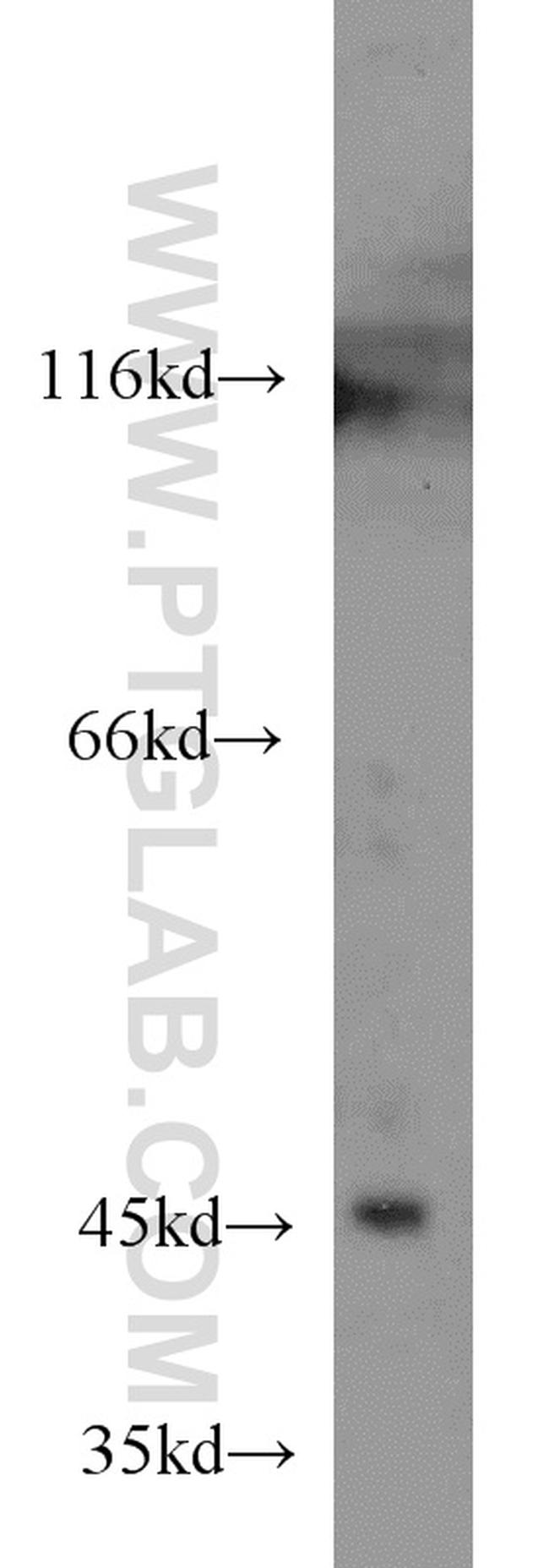 EXOG Antibody in Western Blot (WB)