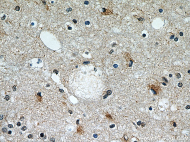 CCT4 Antibody in Immunohistochemistry (Paraffin) (IHC (P))