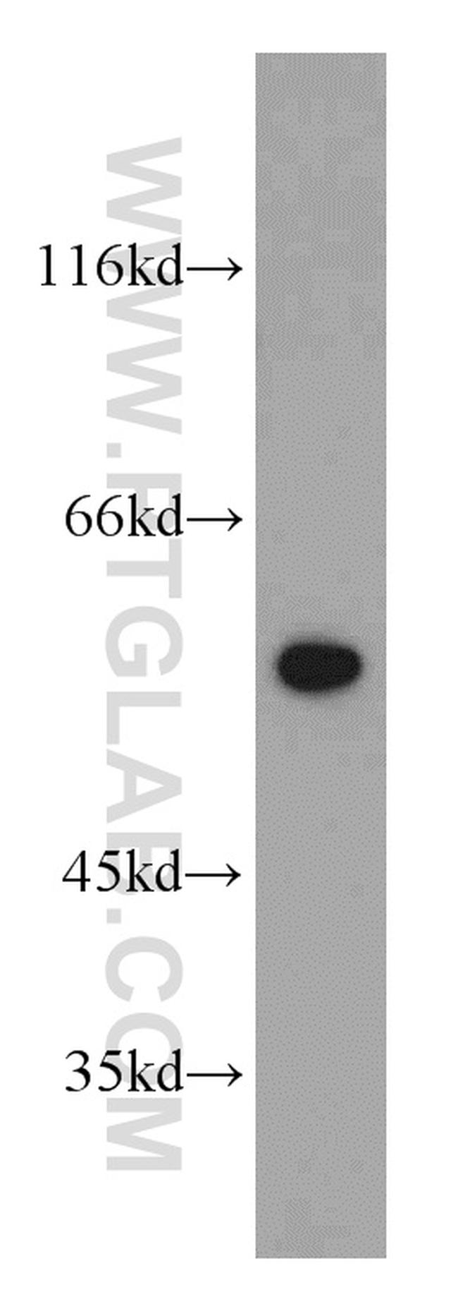 CCT4 Antibody in Western Blot (WB)