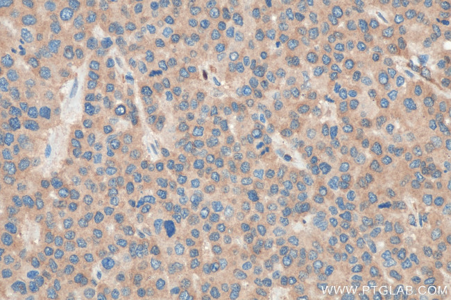 CCT4 Antibody in Immunohistochemistry (Paraffin) (IHC (P))