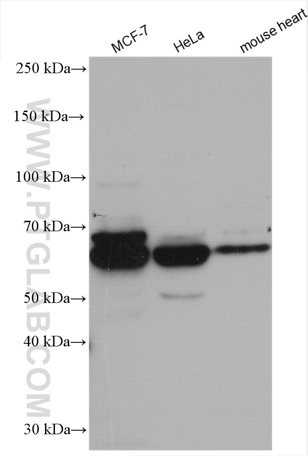 CCT4 Antibody in Western Blot (WB)