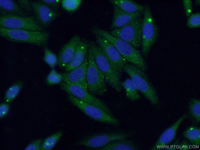 MYLK3 Antibody in Immunocytochemistry (ICC/IF)