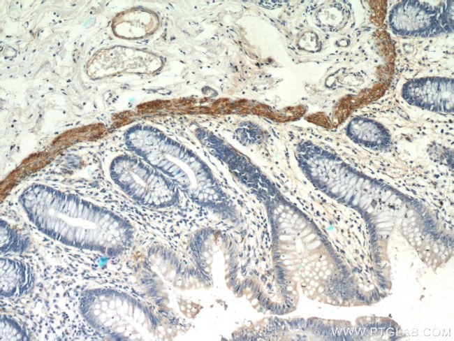 MYLK3 Antibody in Immunohistochemistry (Paraffin) (IHC (P))