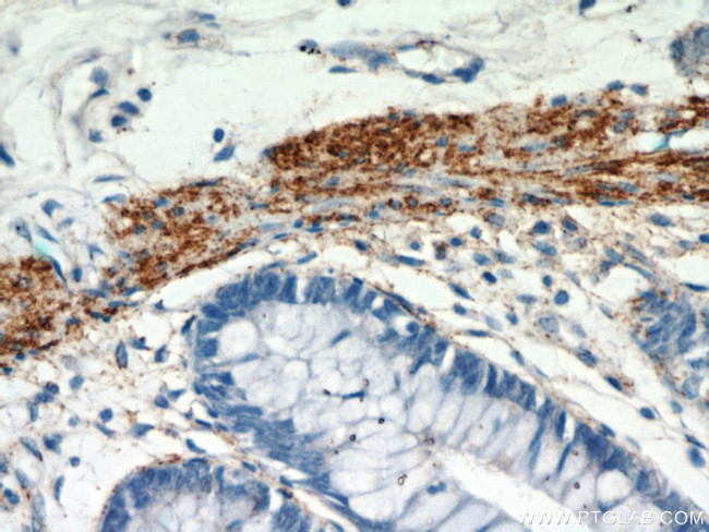 MYLK3 Antibody in Immunohistochemistry (Paraffin) (IHC (P))