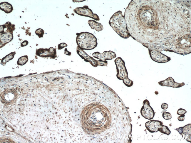 L1TD1 Antibody in Immunohistochemistry (Paraffin) (IHC (P))