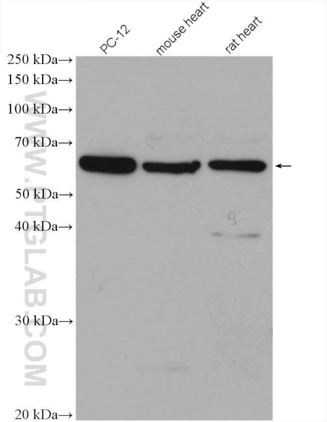 FOXO4 Antibody in Western Blot (WB)