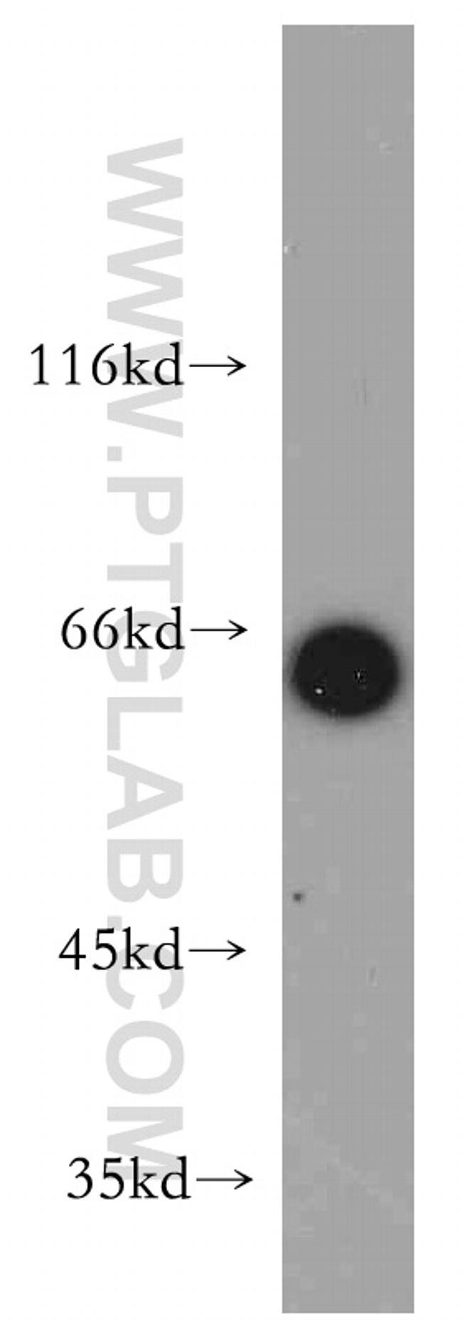 FOXO4 Antibody in Western Blot (WB)