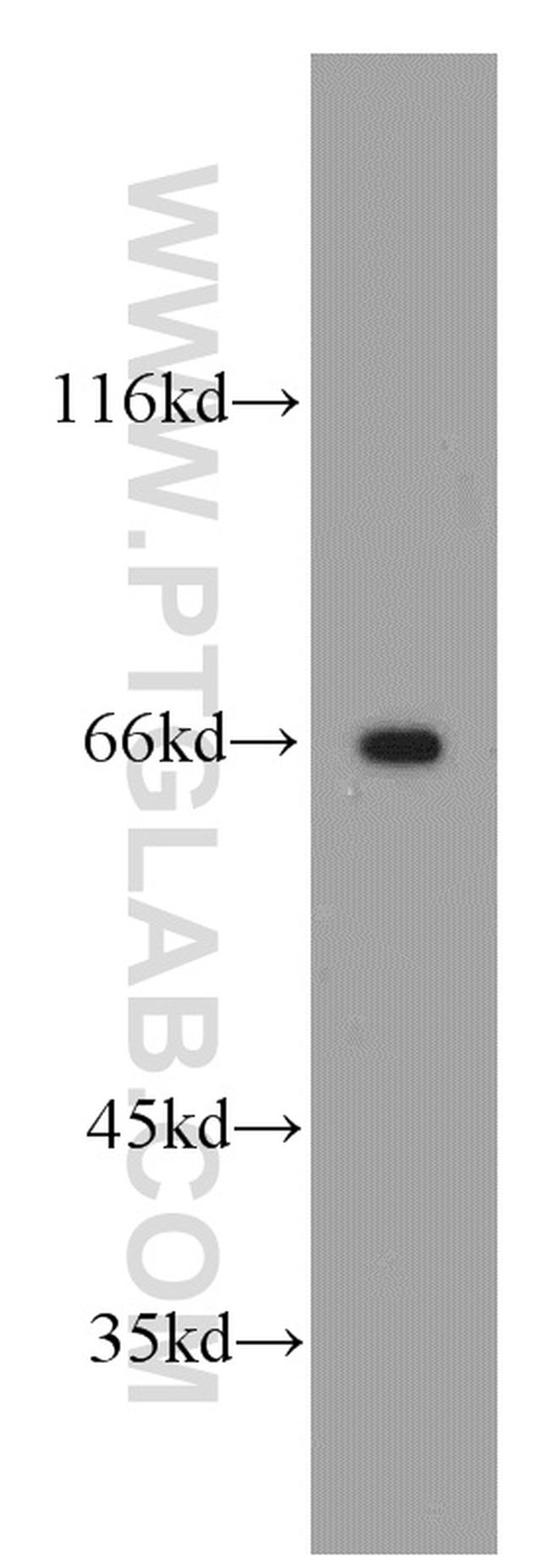 FOXO4 Antibody in Western Blot (WB)