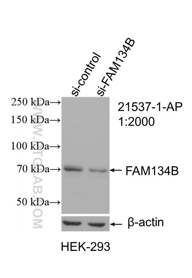 FAM134B Antibody in Western Blot (WB)