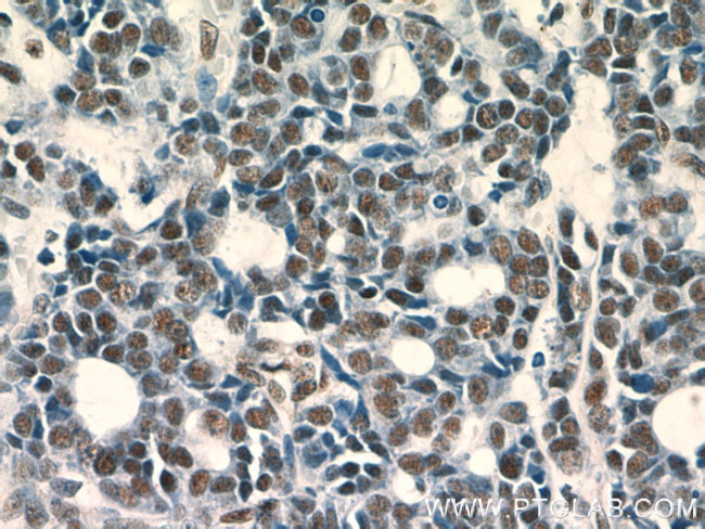 GABPA Antibody in Immunohistochemistry (Paraffin) (IHC (P))