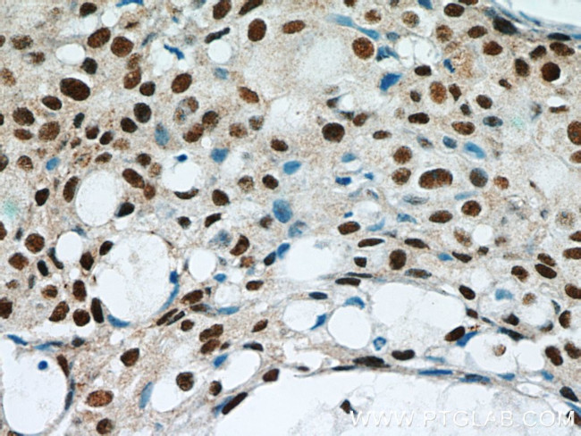 GABPA Antibody in Immunohistochemistry (Paraffin) (IHC (P))