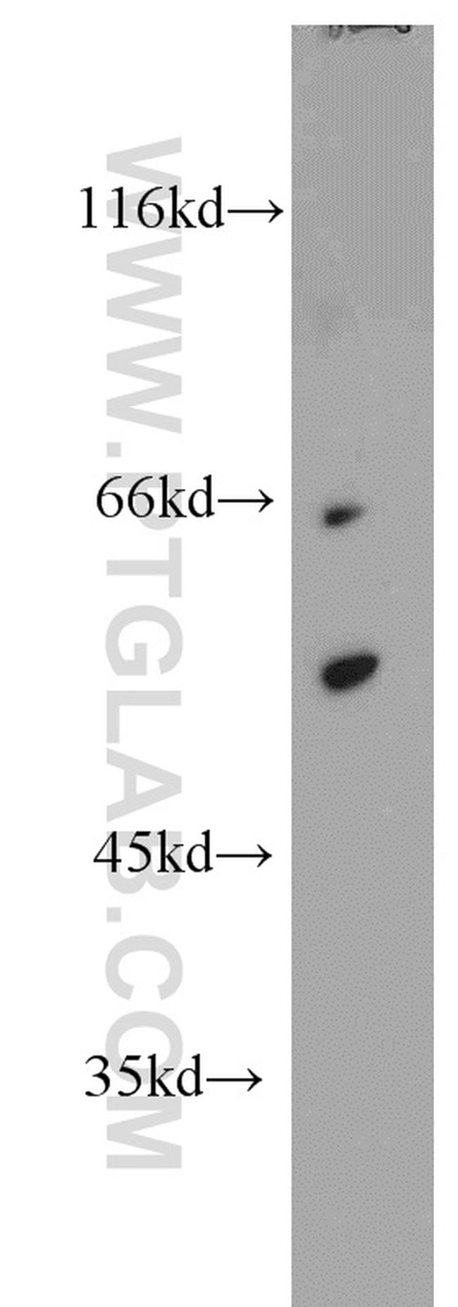 GABPA Antibody in Western Blot (WB)