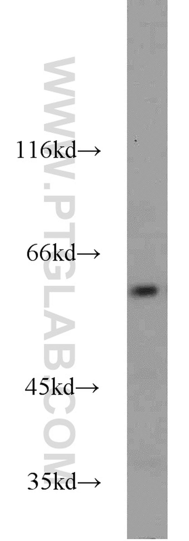 GABPA Antibody in Western Blot (WB)