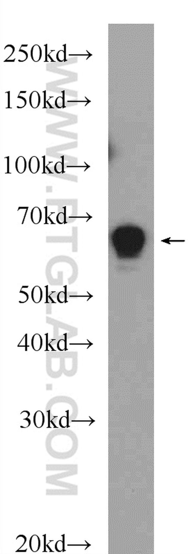 GABPA Antibody in Western Blot (WB)