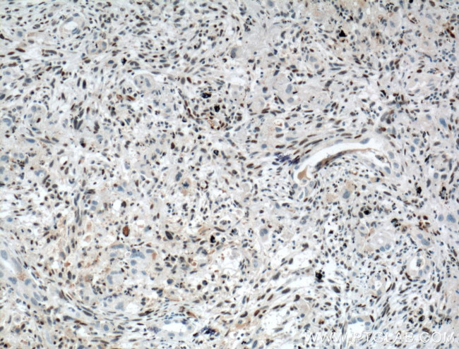 ZEB1 Antibody in Immunohistochemistry (Paraffin) (IHC (P))