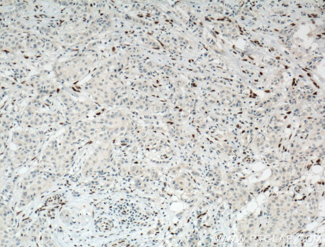 ZEB1 Antibody in Immunohistochemistry (Paraffin) (IHC (P))