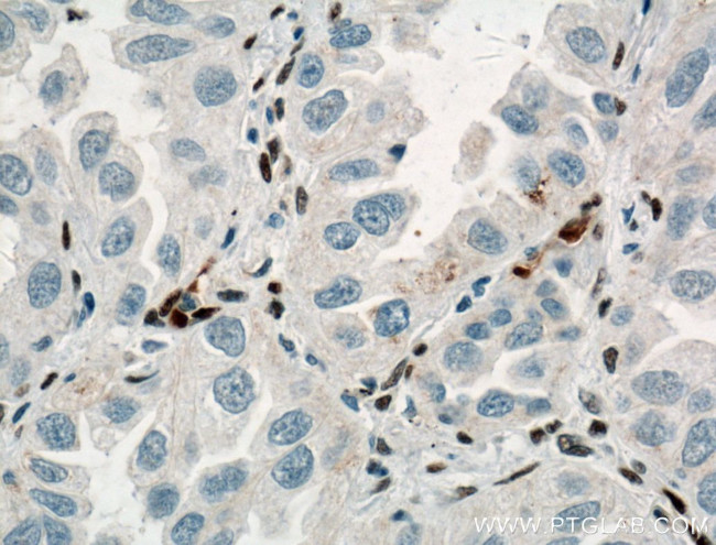 ZEB1 Antibody in Immunohistochemistry (Paraffin) (IHC (P))