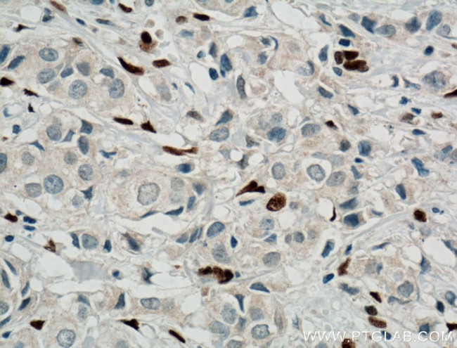 ZEB1 Antibody in Immunohistochemistry (Paraffin) (IHC (P))