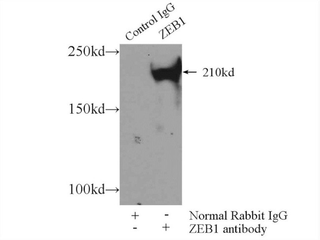 ZEB1 Antibody in Immunoprecipitation (IP)