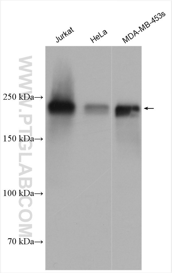 ZEB1 Antibody in Western Blot (WB)