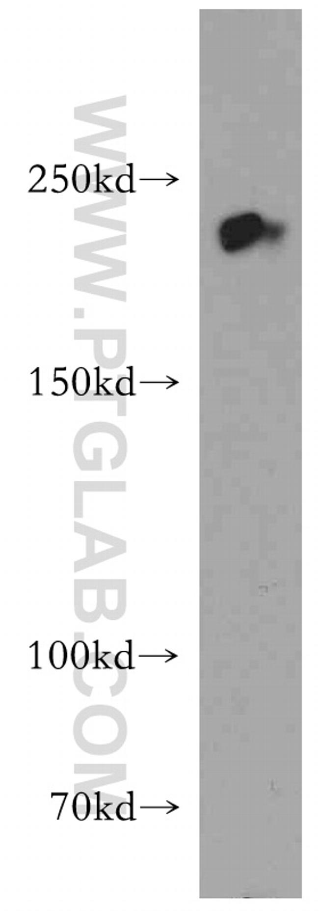 ZEB1 Antibody in Western Blot (WB)