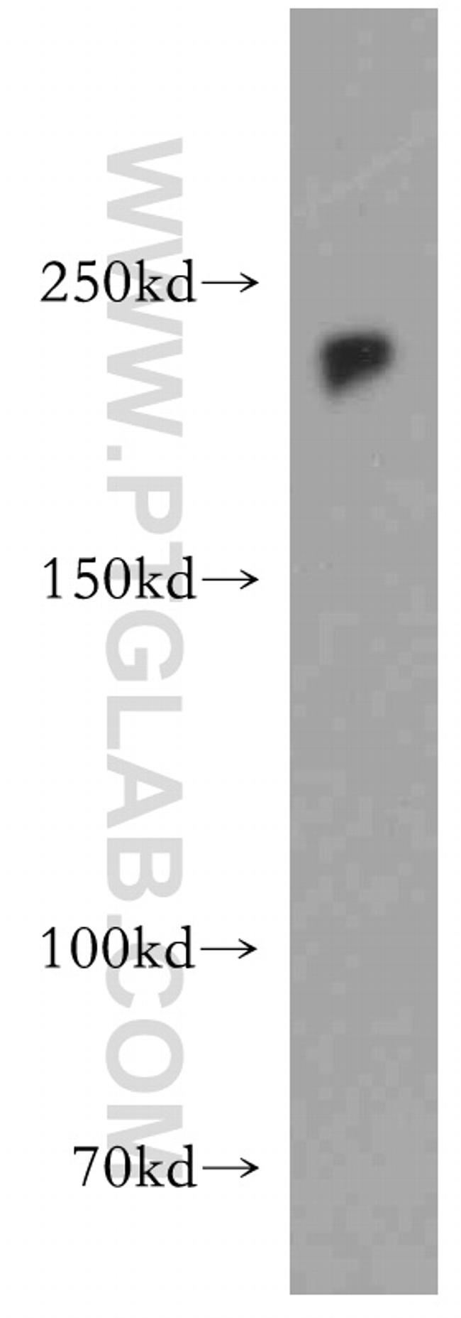 ZEB1 Antibody in Western Blot (WB)