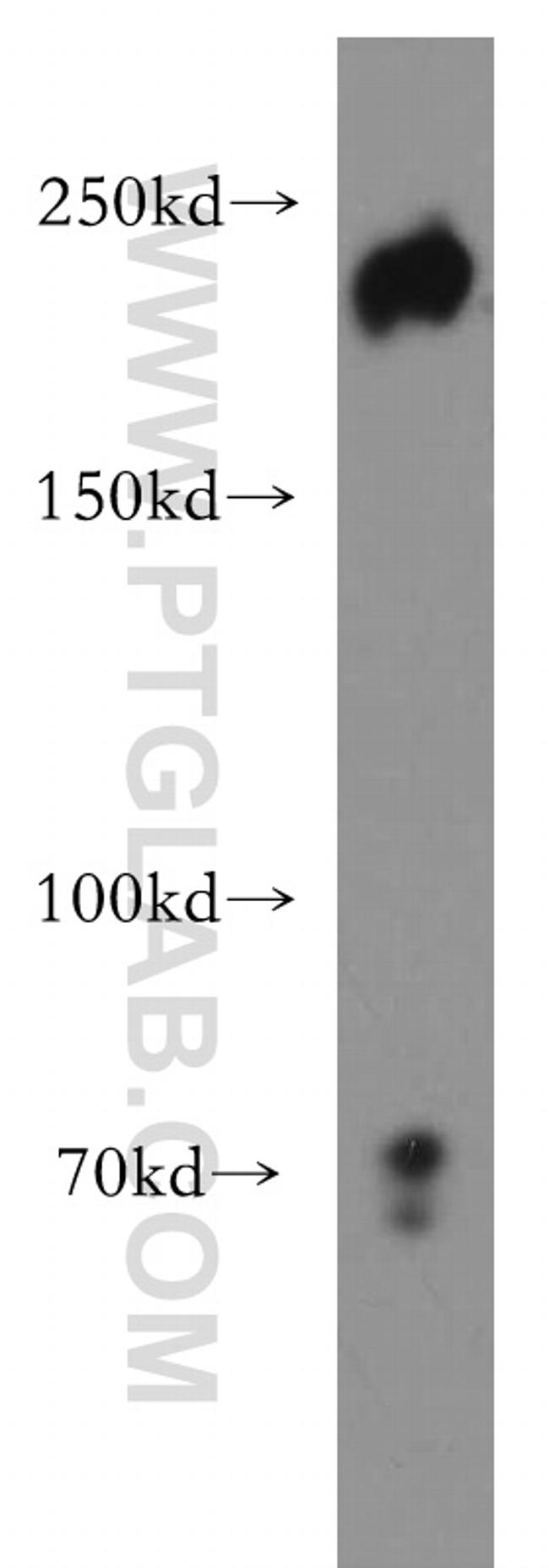 ZEB1 Antibody in Western Blot (WB)