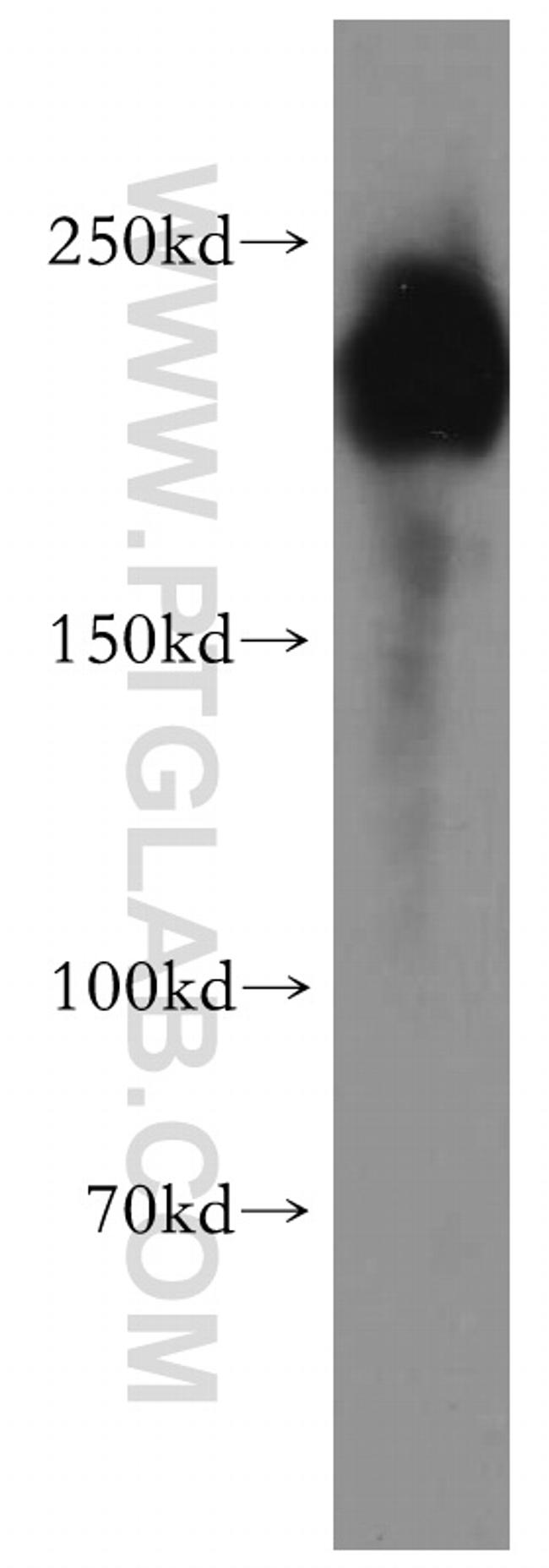 ZEB1 Antibody in Western Blot (WB)