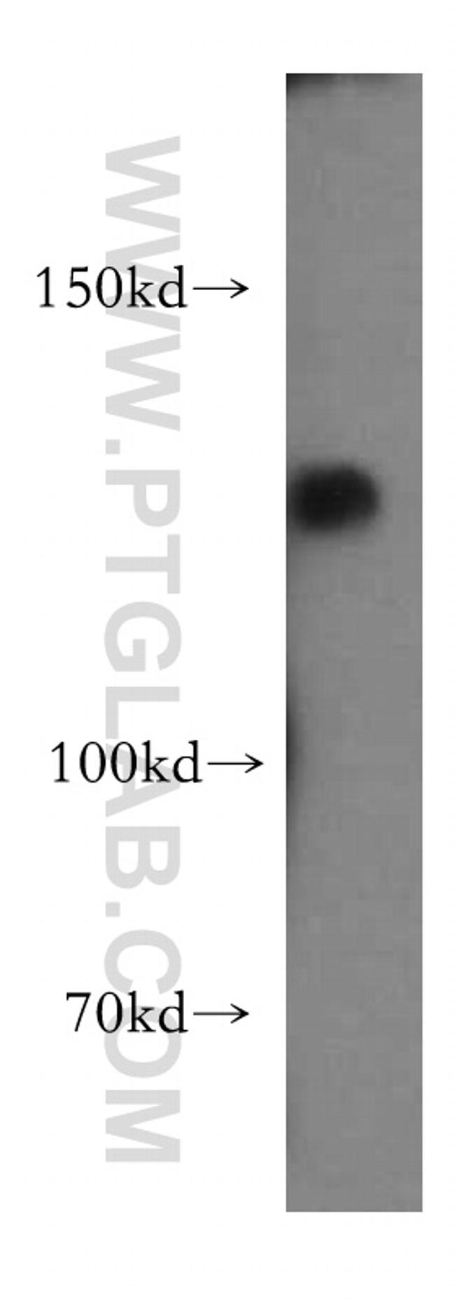 UBE4A Antibody in Western Blot (WB)