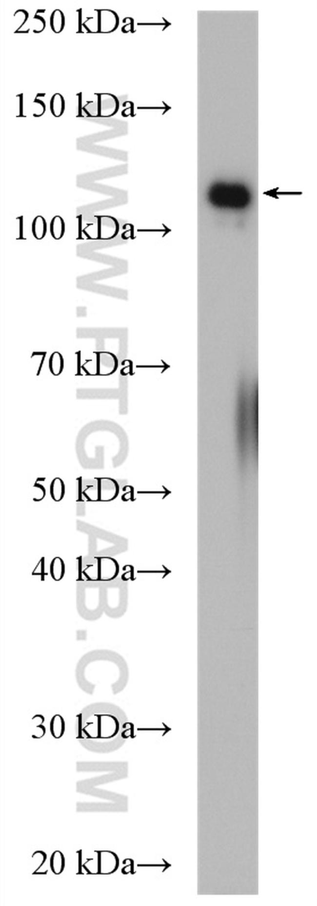 UBE4A Antibody in Western Blot (WB)