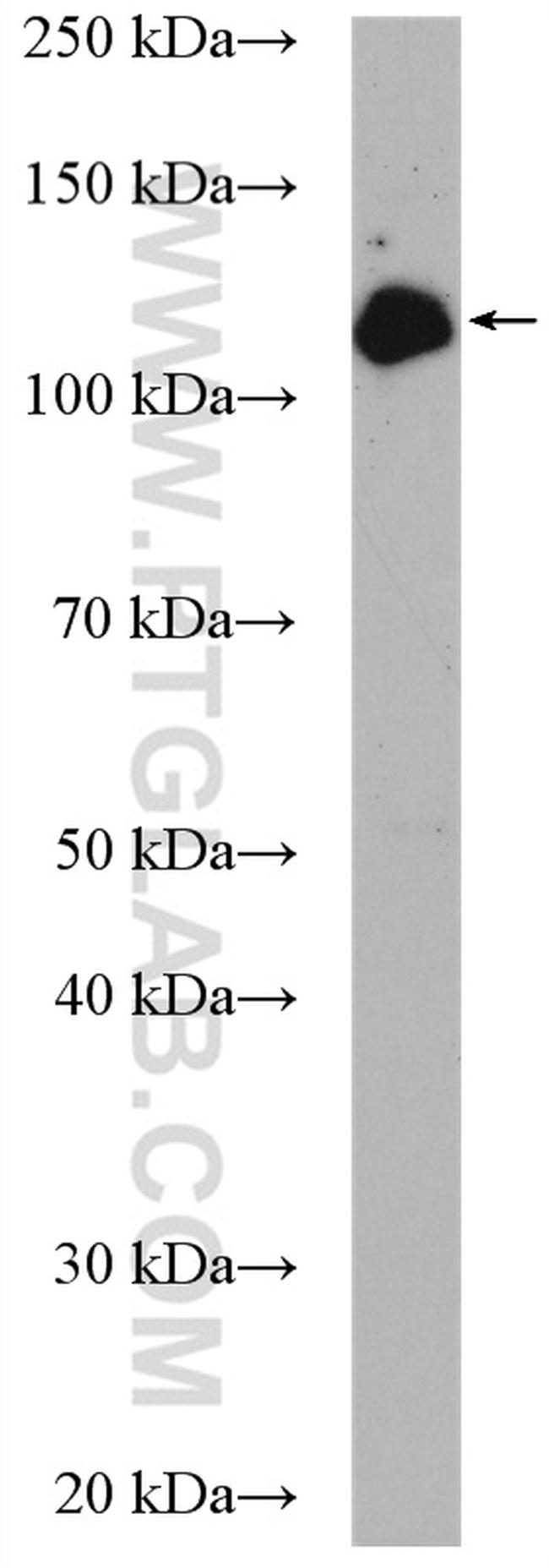 UBE4A Antibody in Western Blot (WB)