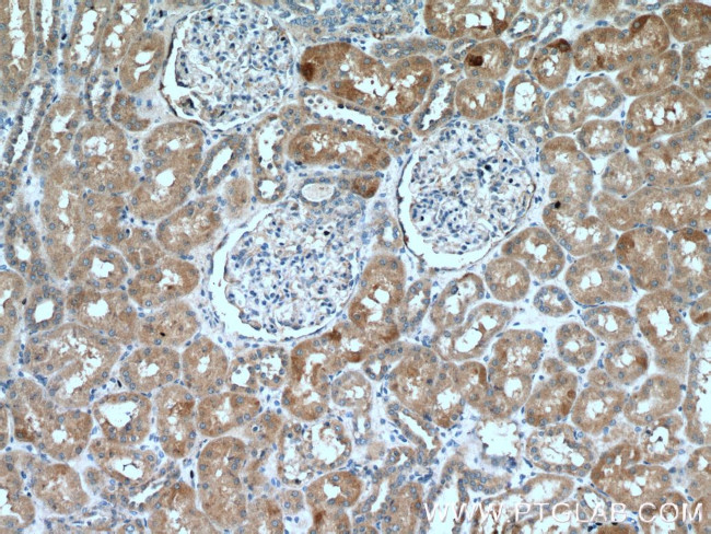 NRBP2 Antibody in Immunohistochemistry (Paraffin) (IHC (P))