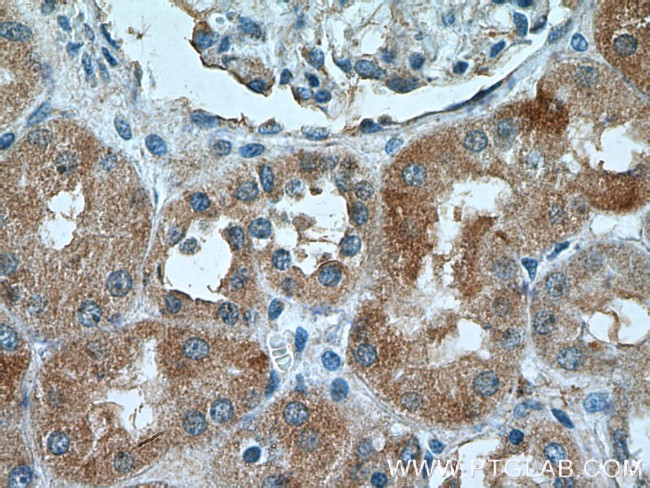 NRBP2 Antibody in Immunohistochemistry (Paraffin) (IHC (P))