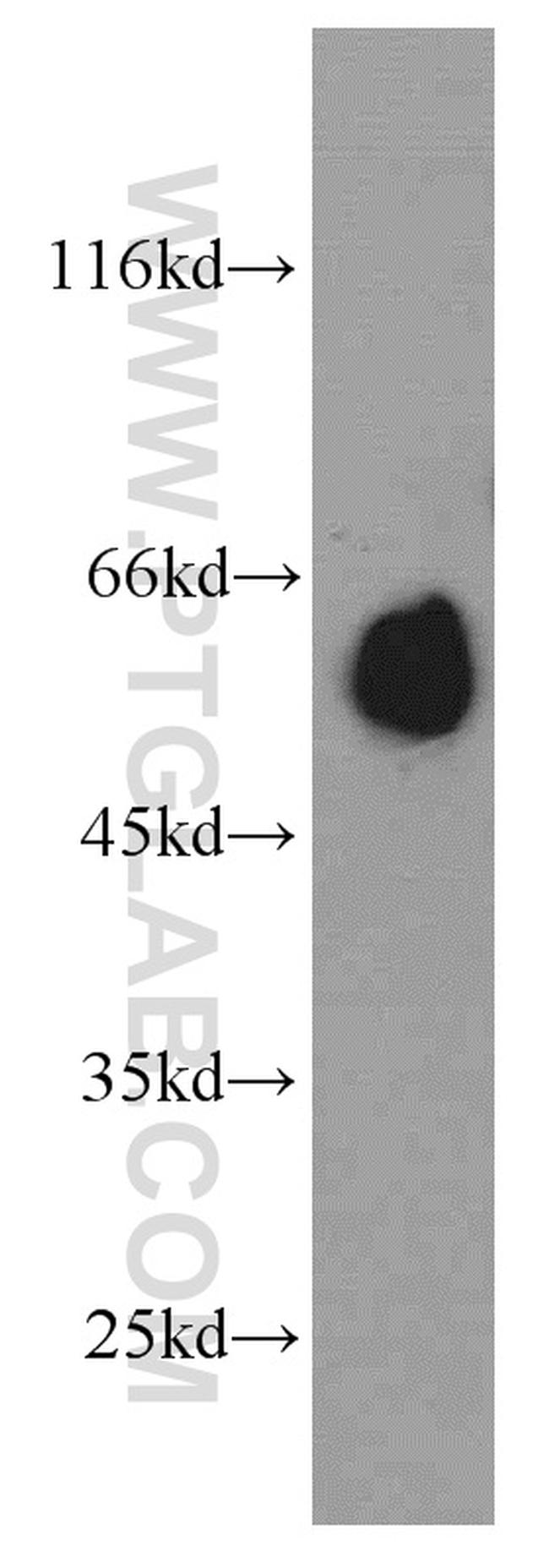 NRBP2 Antibody in Western Blot (WB)