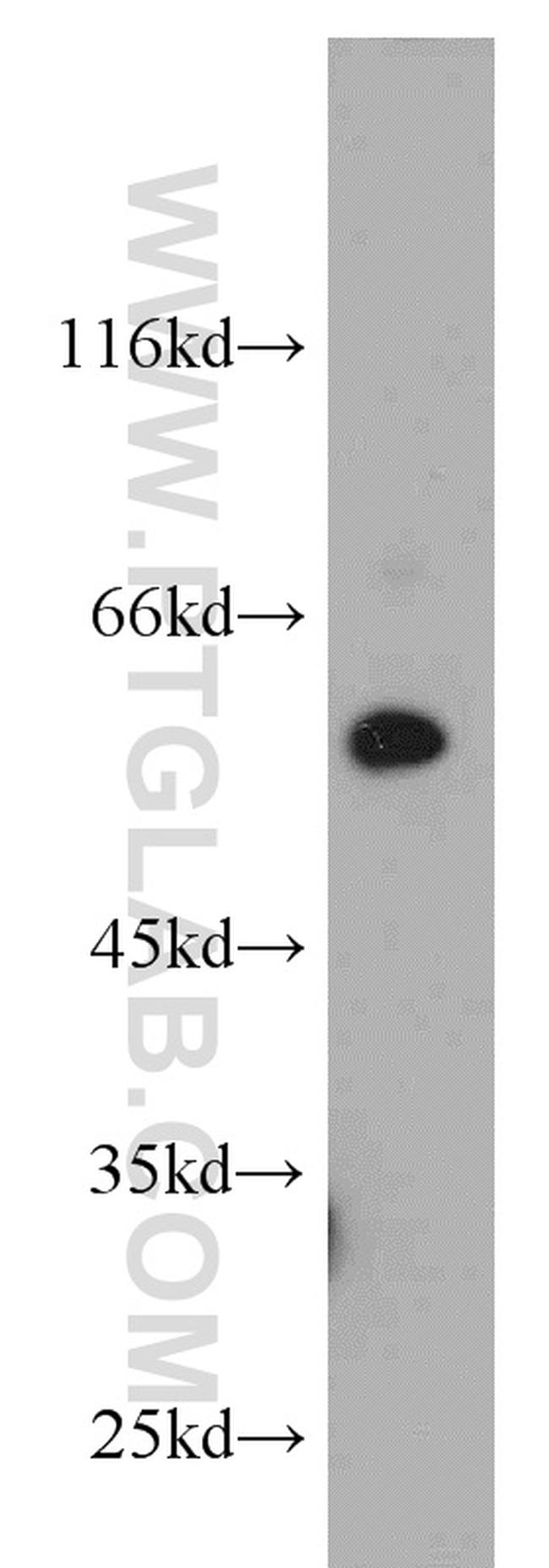 NRBP2 Antibody in Western Blot (WB)