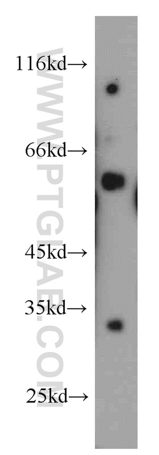 NRBP2 Antibody in Western Blot (WB)