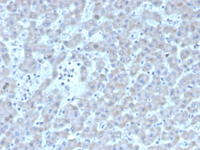 Coagulation Factor VII/F7 Antibody in Immunohistochemistry (Paraffin) (IHC (P))