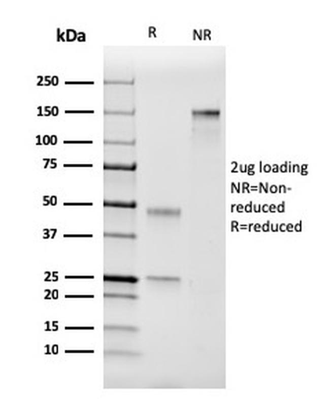 Coagulation Factor VII/F7 Antibody in SDS-PAGE (SDS-PAGE)