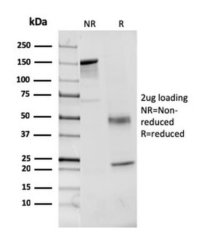 Coagulation Factor VII/F7 Antibody in SDS-PAGE (SDS-PAGE)