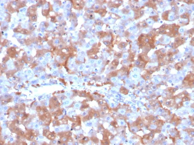 Coagulation Factor VII/F7 Antibody in Immunohistochemistry (Paraffin) (IHC (P))