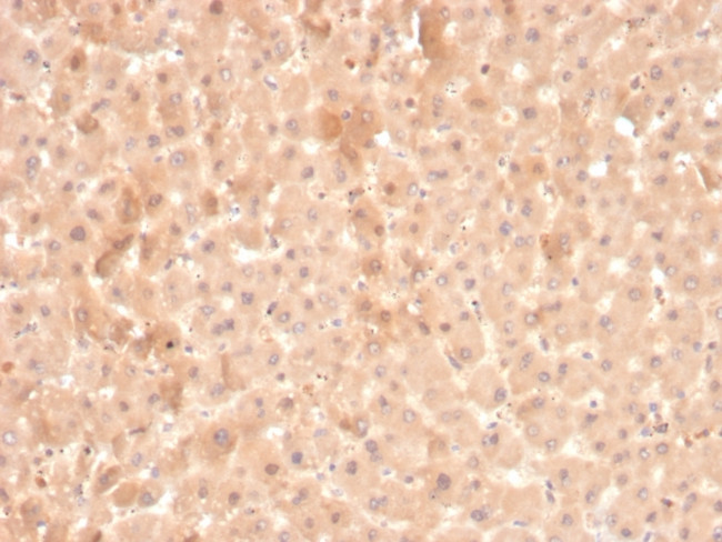 Coagulation Factor VII/F7 Antibody in Immunohistochemistry (Paraffin) (IHC (P))