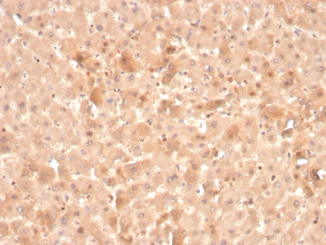 Coagulation Factor VII/F7 Antibody in Immunohistochemistry (Paraffin) (IHC (P))