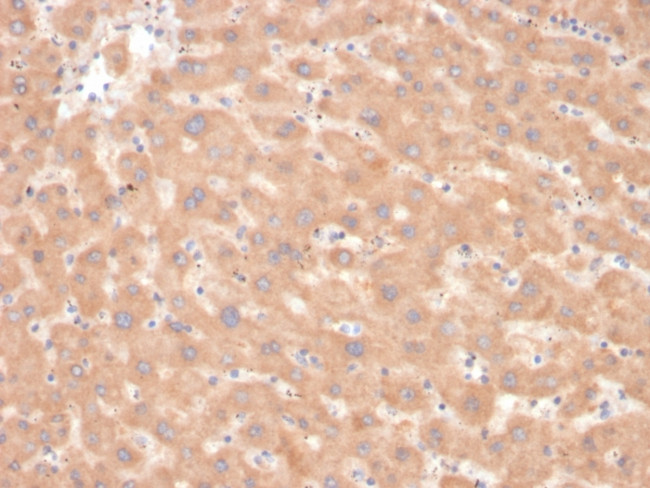 Coagulation Factor VII/F7 Antibody in Immunohistochemistry (Paraffin) (IHC (P))