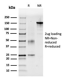 Coagulation Factor VII/F7 Antibody in SDS-PAGE (SDS-PAGE)