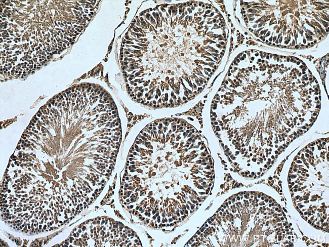 MARK1 Antibody in Immunohistochemistry (Paraffin) (IHC (P))