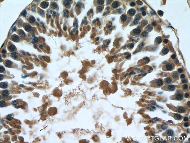 MARK1 Antibody in Immunohistochemistry (Paraffin) (IHC (P))