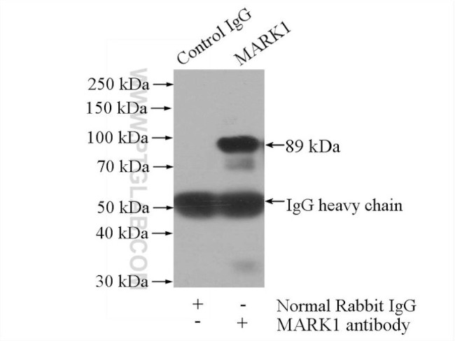 MARK1 Antibody in Immunoprecipitation (IP)